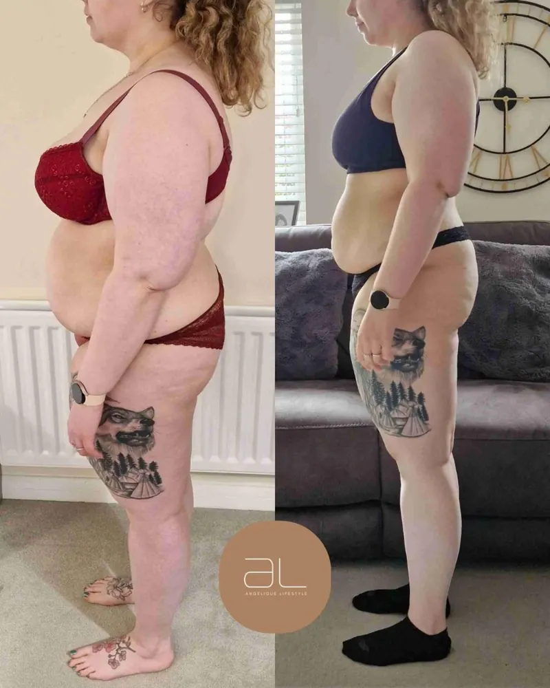 Client before and after, side view